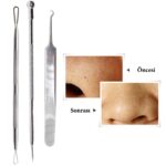 BUFFER® Paslanmaz Çelik Siyah Nokta Sivilce ve Akne Temizleyici Set 3lü Kit - Görsel 2